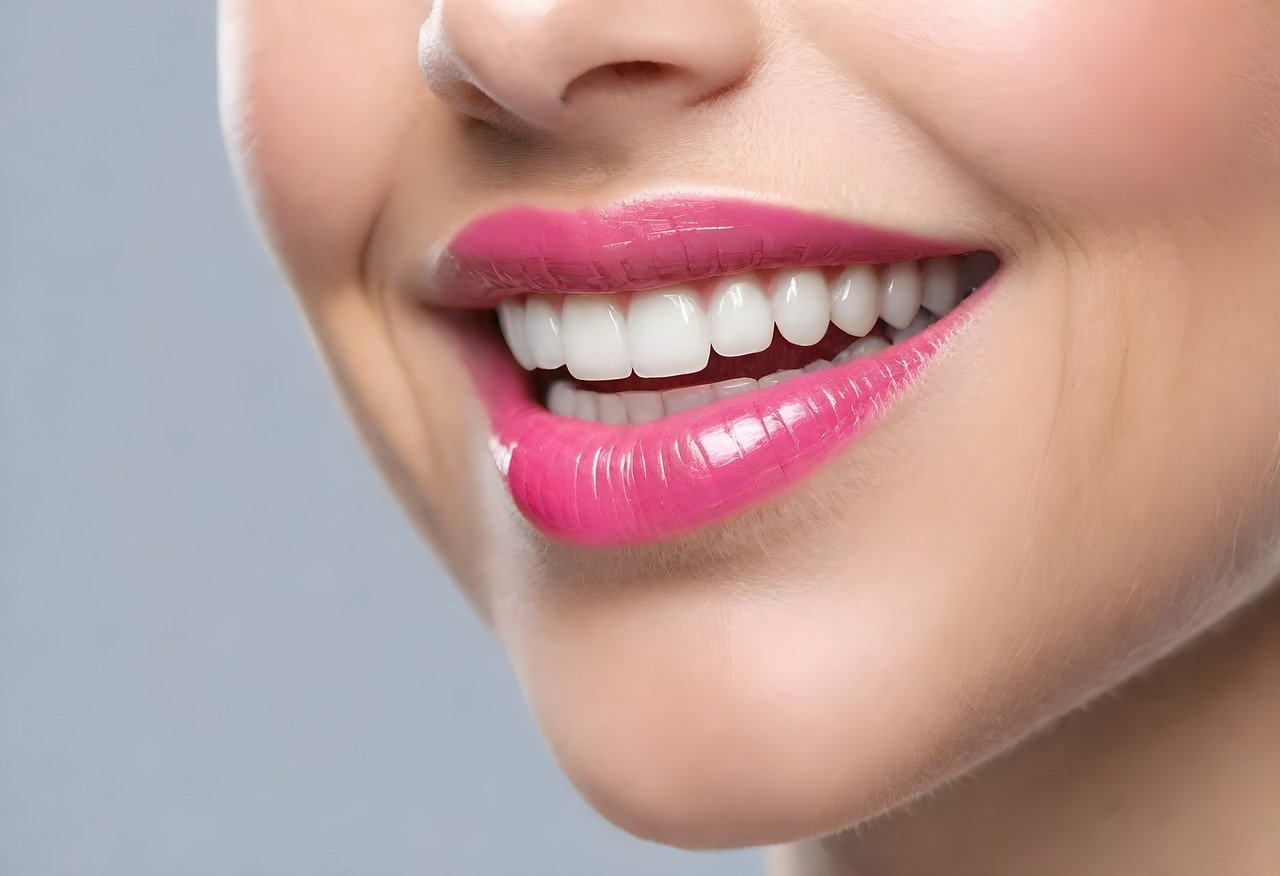 Clear Aligner, Invisalign, Cosmetic dentistry  